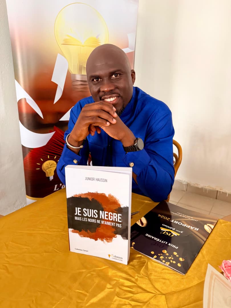 Dépigmentation : Un roman-choc expose la « santé mentale » derrière le blanchiment de la peau